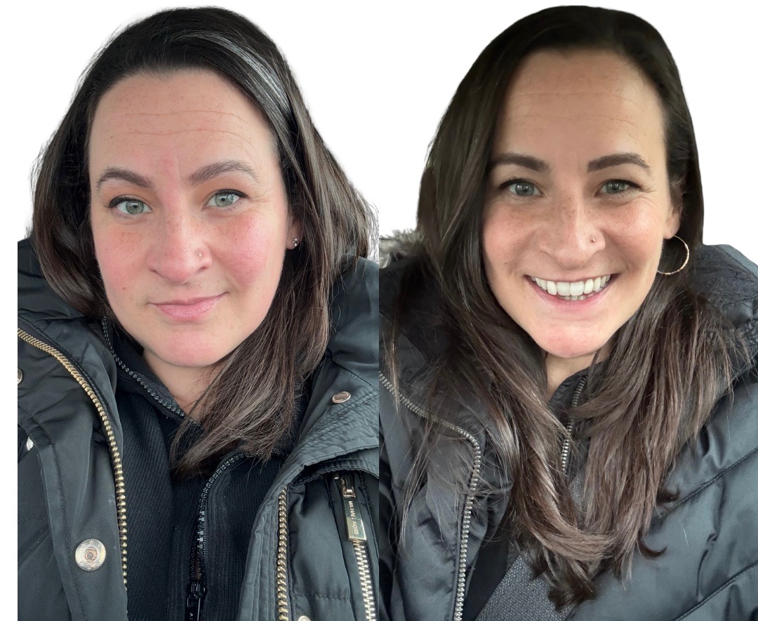 Michele's transformation — before and after